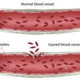 ビタミンDが血管内皮を守る